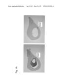 PHARMACEUTICAL COMPOSITION FOR TREATING BONE DISEASES WHICH COMPRISES     PROTEIN COMPRISING FRIZZLED1, FRIZZLED2 OR FRIZZLED7 EXTRACELLULAR     CYSTEINE-RICH DOMAIN diagram and image