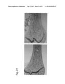 PHARMACEUTICAL COMPOSITION FOR TREATING BONE DISEASES WHICH COMPRISES     PROTEIN COMPRISING FRIZZLED1, FRIZZLED2 OR FRIZZLED7 EXTRACELLULAR     CYSTEINE-RICH DOMAIN diagram and image