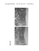 PHARMACEUTICAL COMPOSITION FOR TREATING BONE DISEASES WHICH COMPRISES     PROTEIN COMPRISING FRIZZLED1, FRIZZLED2 OR FRIZZLED7 EXTRACELLULAR     CYSTEINE-RICH DOMAIN diagram and image