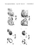 METHOD OF TREATING A PATIENT HAVING AN AUTOIMMUNE DISORDER BY     ADMINISTERING BAFFR POLYPEPTIDE diagram and image