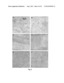 NOVEL TACROLIMUS ANALOGUES, A NEUROPROTECTIVE COMPOSITION COMPRISING THE     SAME, AN IMMUNOSUPPRESSIVE COMPOSITION COMPRISING THE SAME, A METHOD FOR     PREPARING THE SAME, AND A MUTANT FOR PRODUCING THE SAME diagram and image