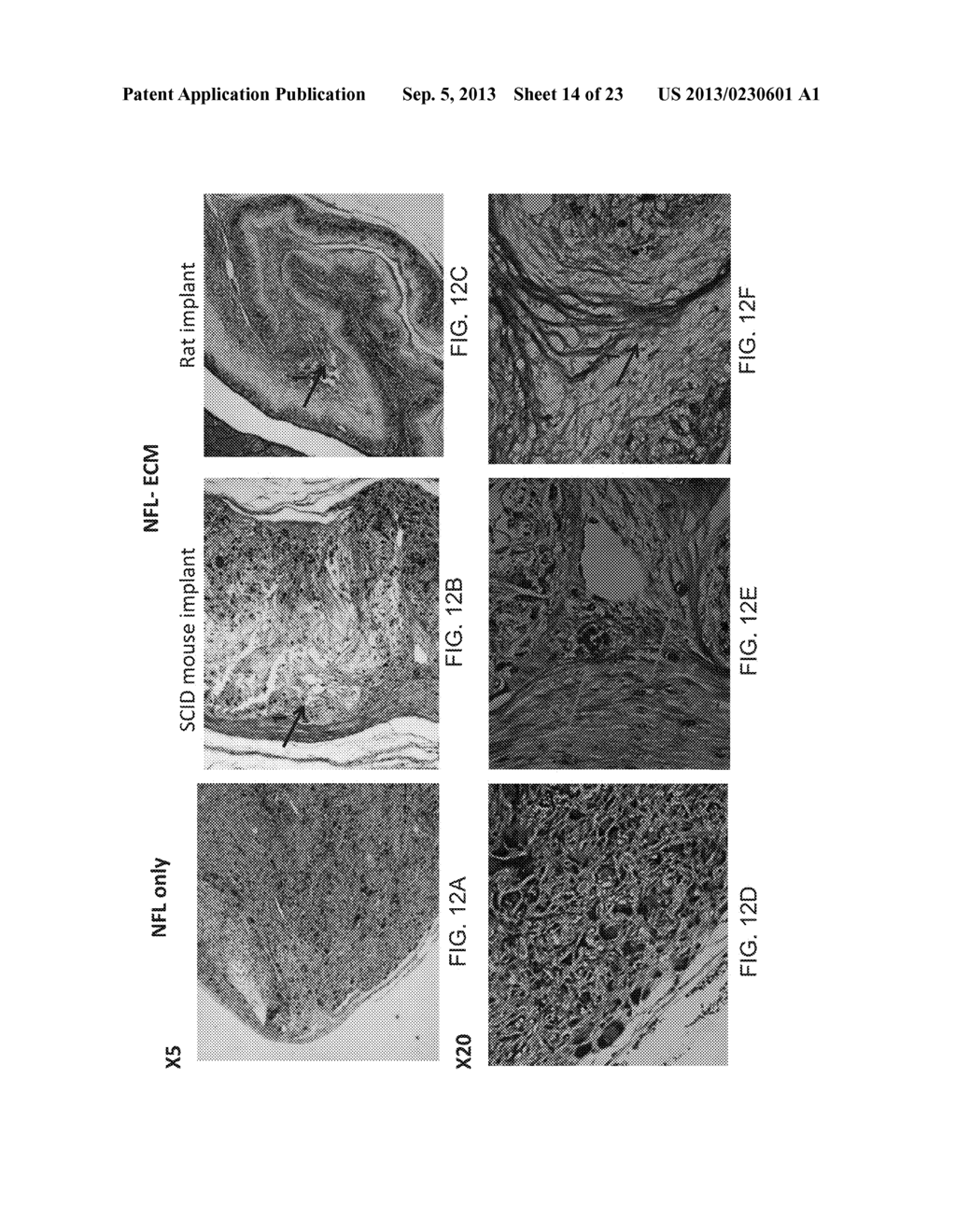 ISOLATED MESENCHYMAL PROGENITOR CELLS AND EXTRACELLULAR MATRIX PRODUCED     THEREBY - diagram, schematic, and image 15