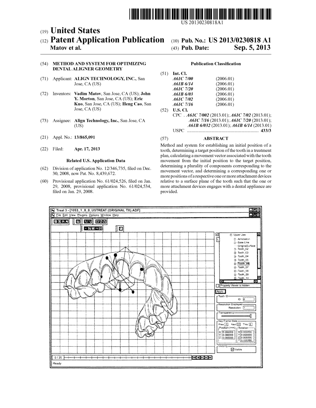 METHOD AND SYSTEM FOR OPTIMIZING DENTAL ALIGNER GEOMETRY - diagram, schematic, and image 01