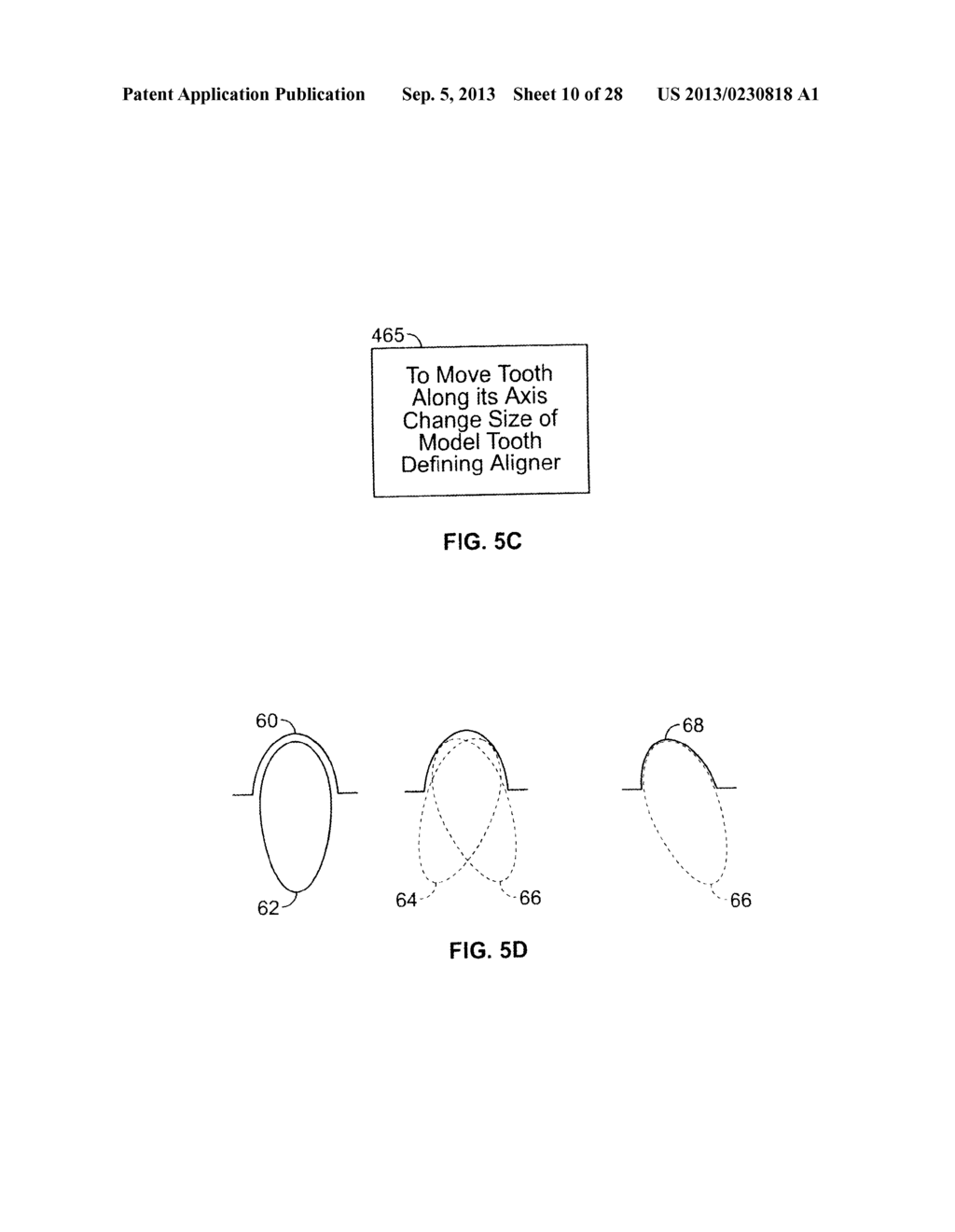 METHOD AND SYSTEM FOR OPTIMIZING DENTAL ALIGNER GEOMETRY - diagram, schematic, and image 11