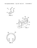 APPARATUS FOR ORTHODONTIC ALIGNER TRAY RETENTION diagram and image