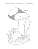 APPARATUS FOR ORTHODONTIC ALIGNER TRAY RETENTION diagram and image