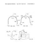 APPARATUS FOR ORTHODONTIC ALIGNER TRAY RETENTION diagram and image