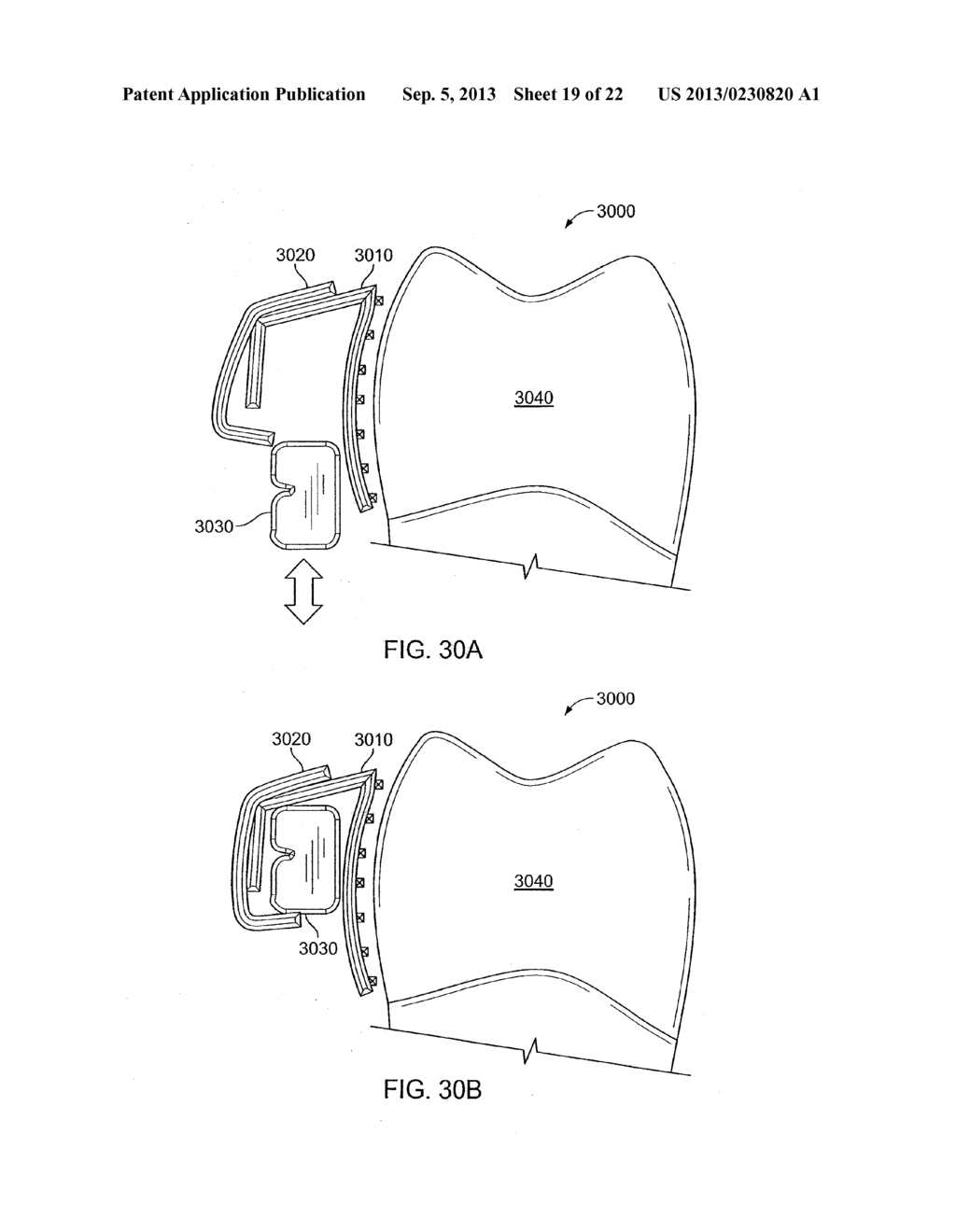 ORTHODONTIC DEVICES - diagram, schematic, and image 20