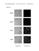 USE OF MOLECULAR MARKERS FOR THE PRECLINICAL PROFILING OF INHIBITORS OF     ENZYMES HAVING HISTONE DEACETYLASE ACTIVITY diagram and image