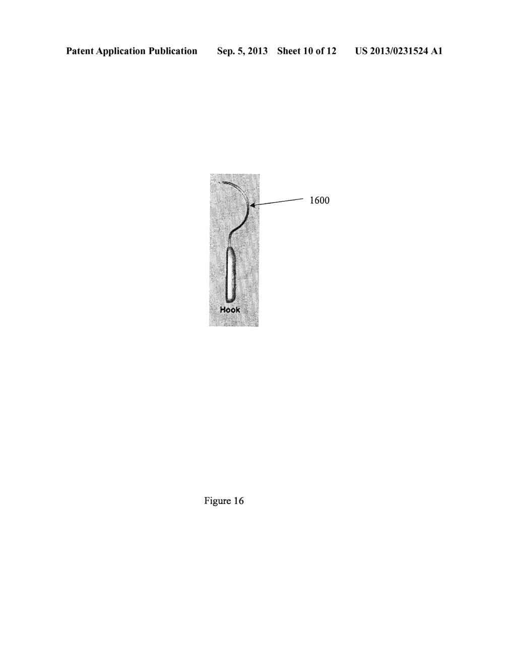 Implantable sling for the treatment of incontinence and method of using     the same - diagram, schematic, and image 11