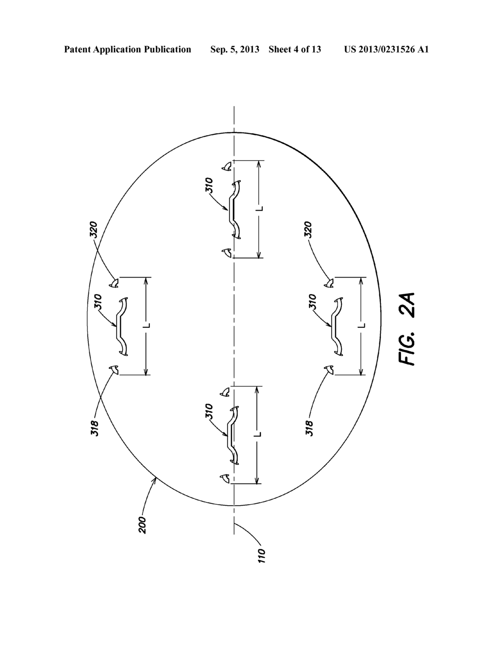 SOFT TISSUE REPAIR PROSTHESIS AND EXPANDABLE DEVICE - diagram, schematic, and image 05