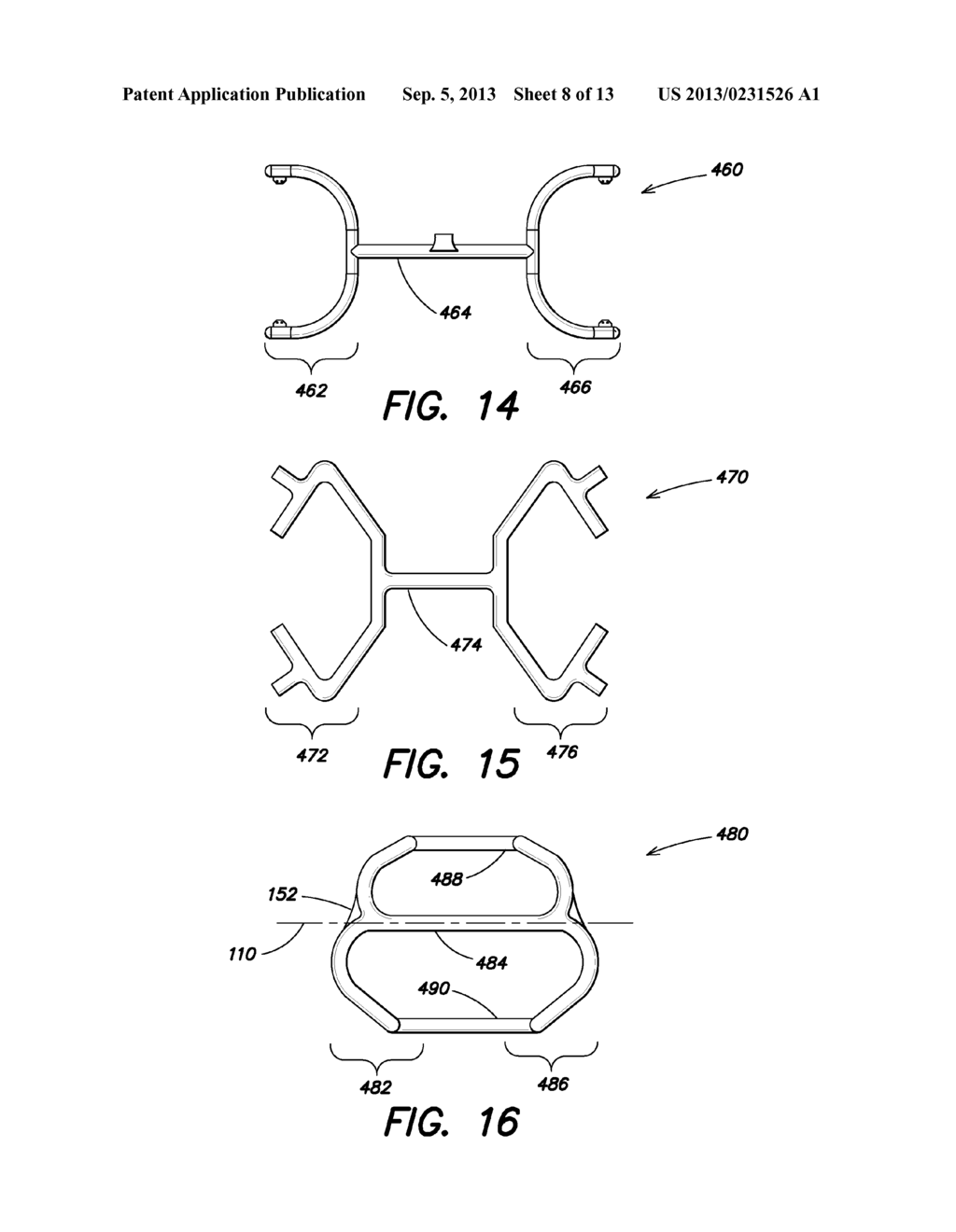 SOFT TISSUE REPAIR PROSTHESIS AND EXPANDABLE DEVICE - diagram, schematic, and image 09