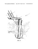 DEVICE AND METHOD FOR SAFELY EXPANDING MINIMALLY INVASIVE SURGICAL     INCISIONS diagram and image