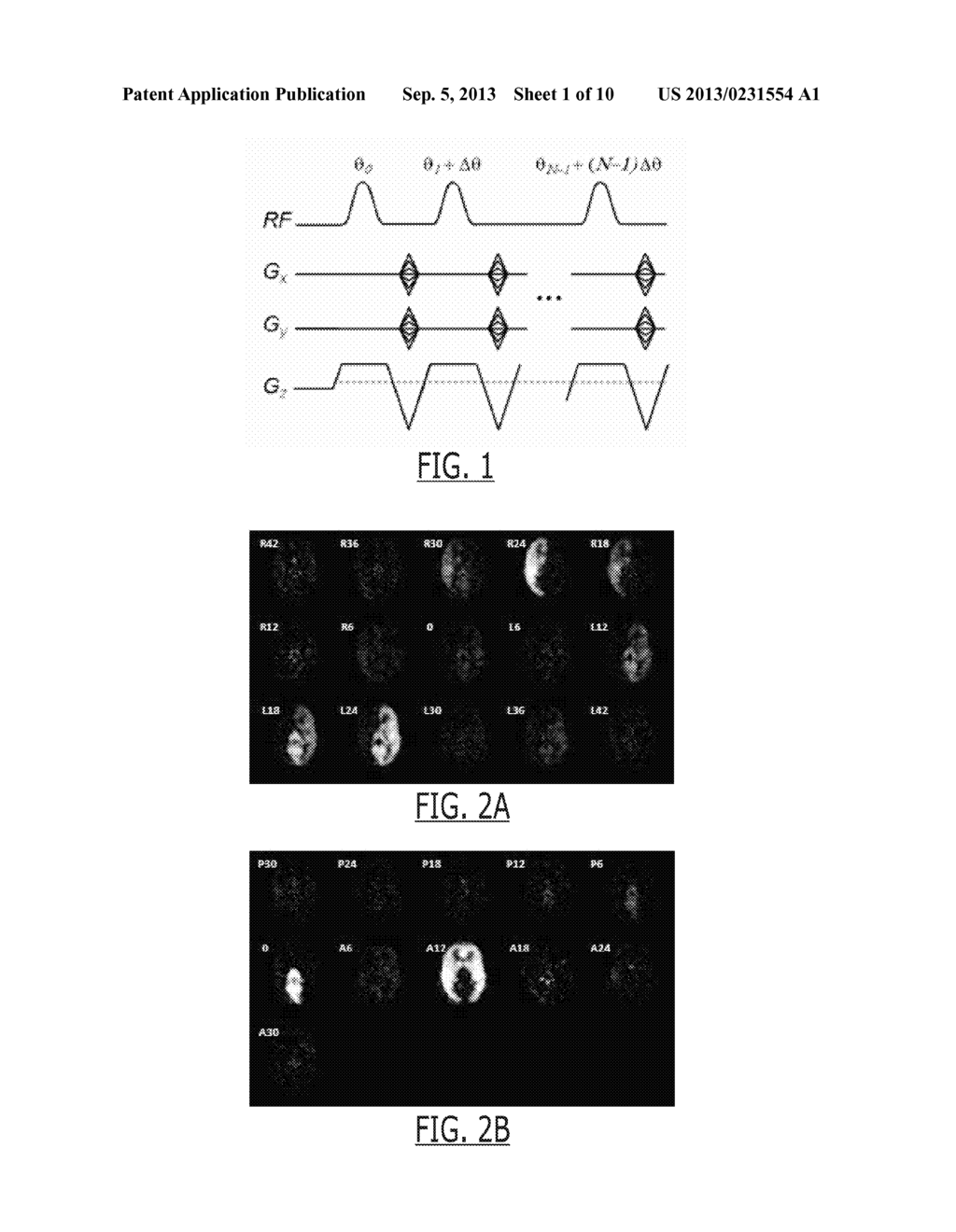 VESSEL ENCODED ARTERIAL SPIN LABELING USING FOURIER ENCODING SUITABLE FOR     VASCULAR TERRITORY MAPPING - diagram, schematic, and image 02