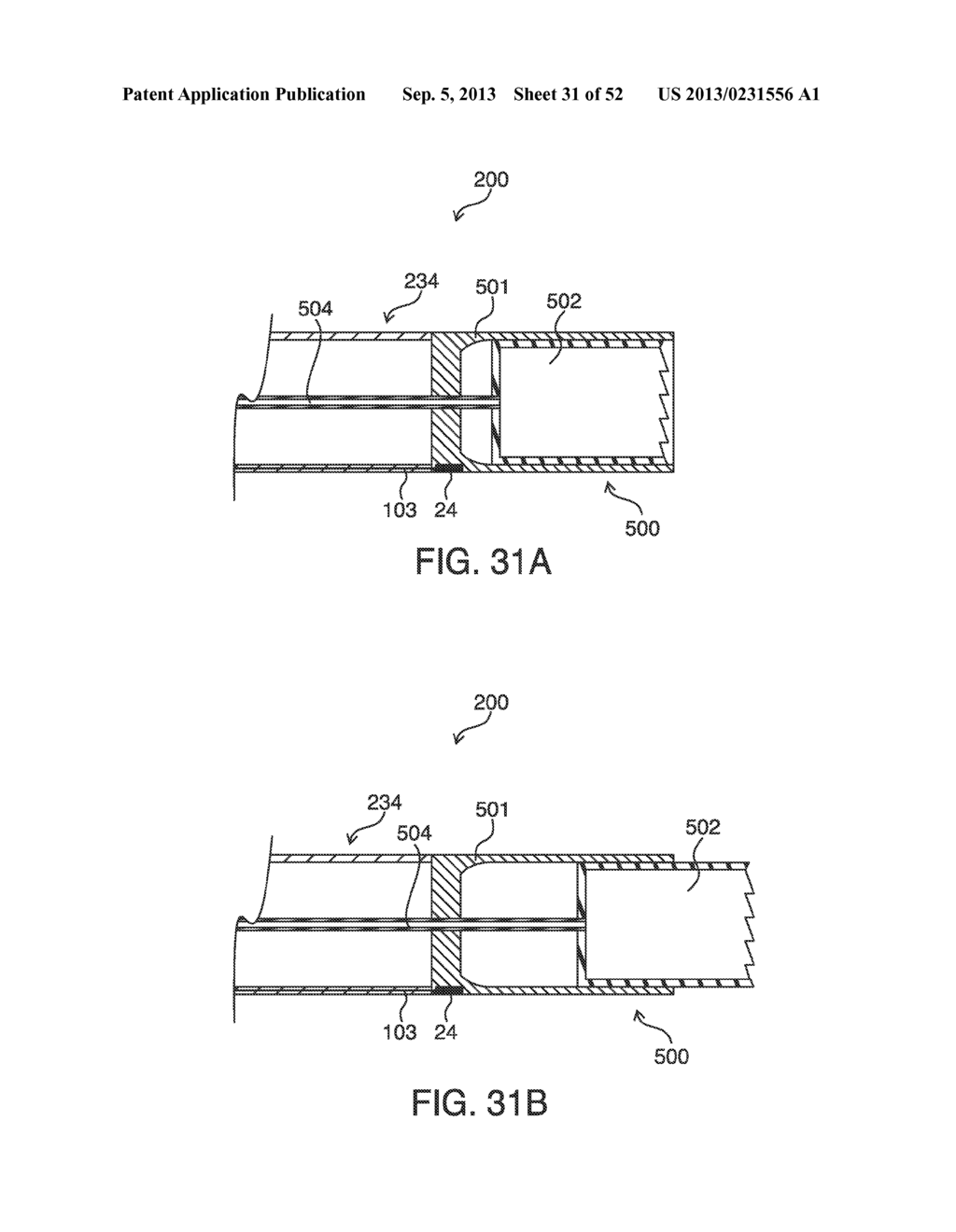 SYSTEMS, METHODS AND DEVICES FOR PLACING A LOCALIZATION ELEMENT IN AN     ORGAN OF A PATIENT FOR FOUR DIMENSIONAL SOFT TISSUE NAVIGATION - diagram, schematic, and image 32