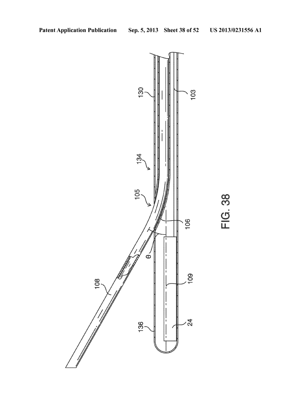 SYSTEMS, METHODS AND DEVICES FOR PLACING A LOCALIZATION ELEMENT IN AN     ORGAN OF A PATIENT FOR FOUR DIMENSIONAL SOFT TISSUE NAVIGATION - diagram, schematic, and image 39