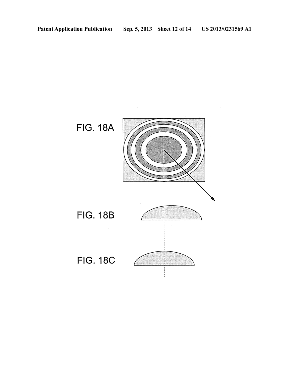 MEDICAL ULTRASOUND 2-D TRANSDUCER ARRAY USING FRESNEL LENS APPROACH - diagram, schematic, and image 13