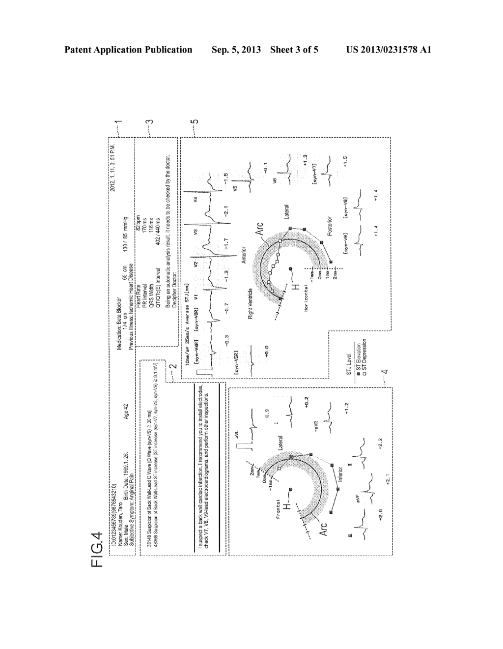 ELECTROCARDIOGRAM ANALYSIS REPORT, ELECTROCARDIOGRAM ANALYSIS APPARATUS,     AND ELECTROCARDIOGRAM ANALYSIS PROGRAM - diagram, schematic, and image 04