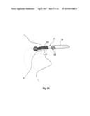 BIOLOGICAL TISSUE COLLECTING TOOL AND BIOLOGICAL TISSUE COLLECTION METHOD     USING THE SAME diagram and image