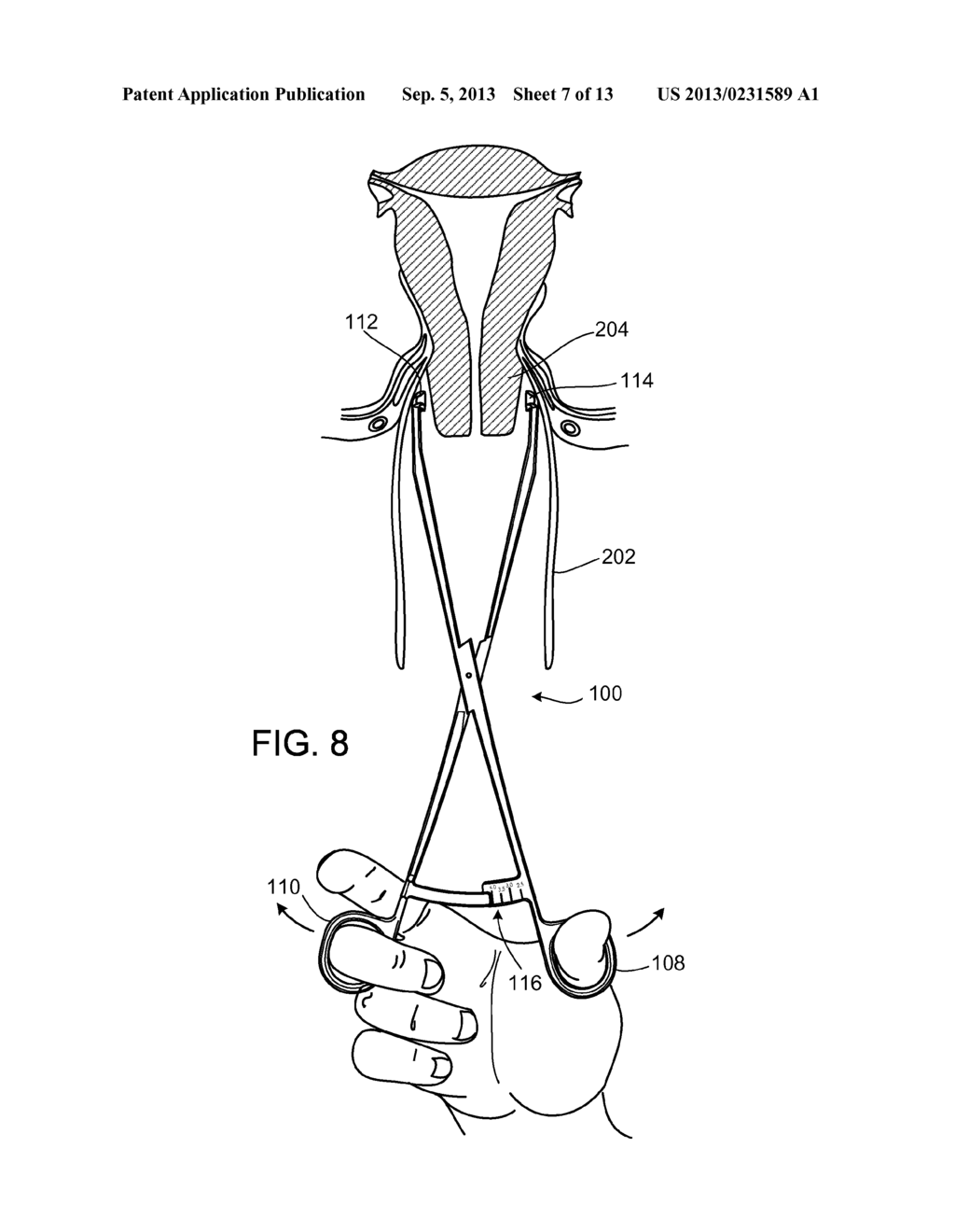 Cervical Sizing Devices and Related Kits and Methods - diagram, schematic, and image 08