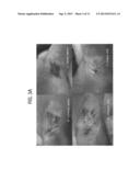 Electrosurgical Methods and Devices Employing Phase-Controlled     Radiofrequency Energy diagram and image