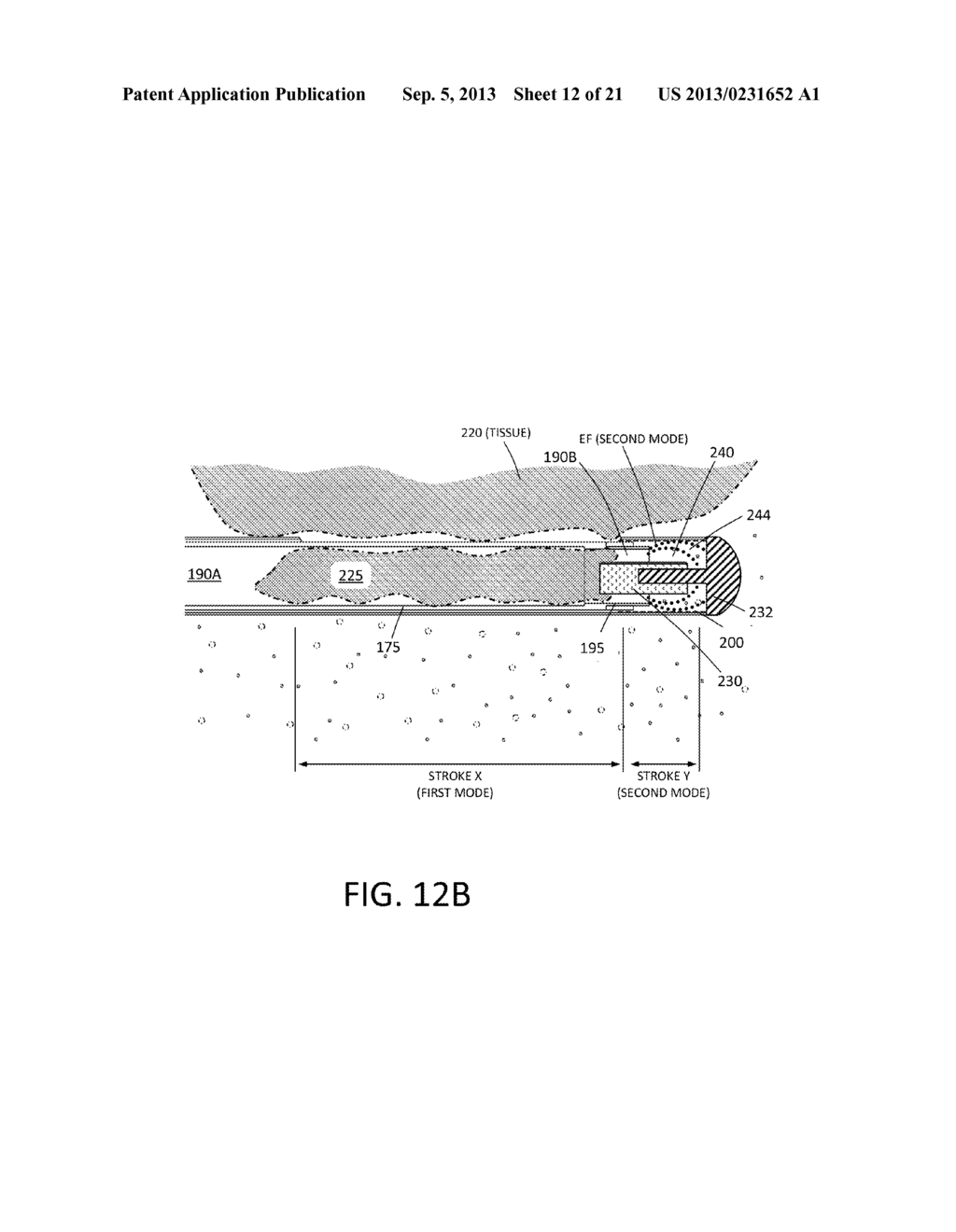 TISSUE EXTRACTION DEVICES AND METHODS - diagram, schematic, and image 13