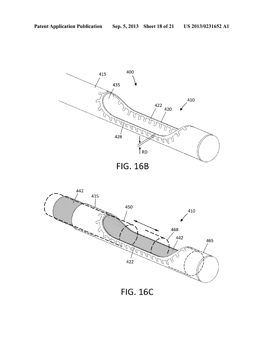 TISSUE EXTRACTION DEVICES AND METHODS - diagram, schematic, and image 19