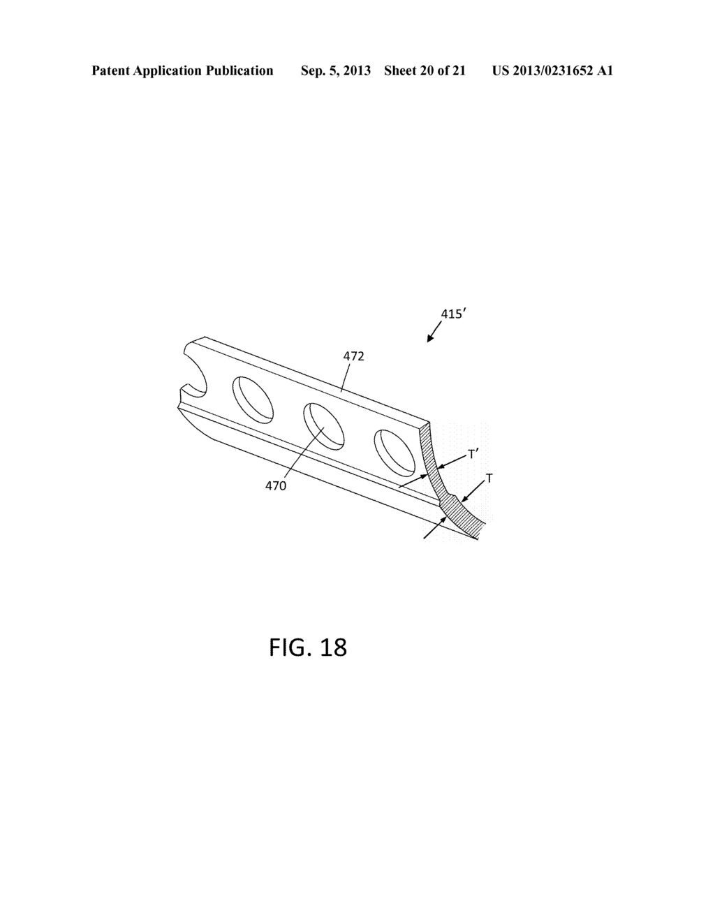 TISSUE EXTRACTION DEVICES AND METHODS - diagram, schematic, and image 21