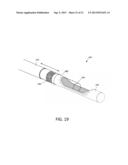 TISSUE EXTRACTION DEVICES AND METHODS diagram and image