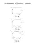 Support instrument with modular intramedullary nail diagram and image