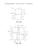 Support instrument with modular intramedullary nail diagram and image