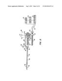 Tissue Separating Catheter Assembly and Method diagram and image