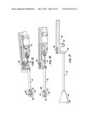 Tissue Separating Catheter Assembly and Method diagram and image