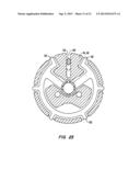 Tissue Separating Catheter Assembly and Method diagram and image