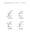 Tissue Separating Catheter Assembly and Method diagram and image