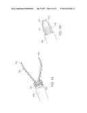 Device and Method for Through the Scope Endoscopic Hemostatic Clipping diagram and image