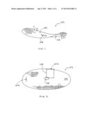 REINFORCEMENT DEVICE WITH DISSOLVABLE LAYER AND ITS USE diagram and image