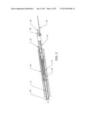 LUMINAL STRUCTURE ANCHORING DEVICES AND METHODS diagram and image