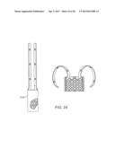 LUMINAL STRUCTURE ANCHORING DEVICES AND METHODS diagram and image