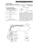 SYSTEMS AND METHODS OF CHARACTERIZING MECHANICAL ACTIVATION PATTERNS FOR     RHYTHM DISCRIMINATION AND THERAPY diagram and image