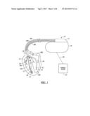 SYSTEMS AND METHODS OF CHARACTERIZING MECHANICAL ACTIVATION PATTERNS FOR     RHYTHM DISCRIMINATION AND THERAPY diagram and image