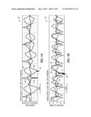 SYSTEMS AND METHODS OF CHARACTERIZING MECHANICAL ACTIVATION PATTERNS FOR     RHYTHM DISCRIMINATION AND THERAPY diagram and image