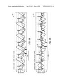 SYSTEMS AND METHODS OF CHARACTERIZING MECHANICAL ACTIVATION PATTERNS FOR     RHYTHM DISCRIMINATION AND THERAPY diagram and image