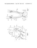 NEURAL STIMULATION MODULATION BASED ON MONITORED CARDIOVASCULAR PARAMETER diagram and image