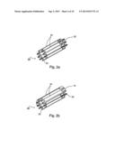 Implantable Graft Assembly and Aneurysm Treatment diagram and image