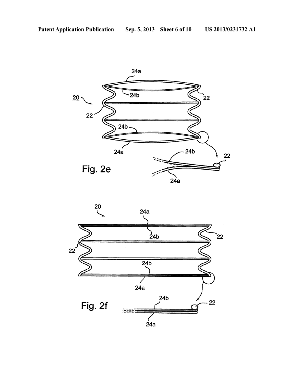 Implantable Graft Assembly and Aneurysm Treatment - diagram, schematic, and image 07