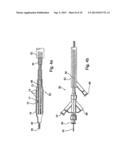 Implantable Graft Assembly and Aneurysm Treatment diagram and image