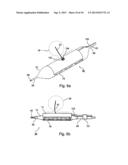 Implantable Graft Assembly and Aneurysm Treatment diagram and image