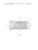 Radiopaque Compositions, Stents and Methods of Preparation diagram and image