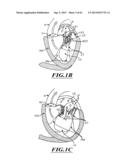 HYDRAULIC DELIVERY SYSTEMS FOR PROSTHETIC HEART VALVE DEVICES AND     ASSOCIATED METHODS diagram and image